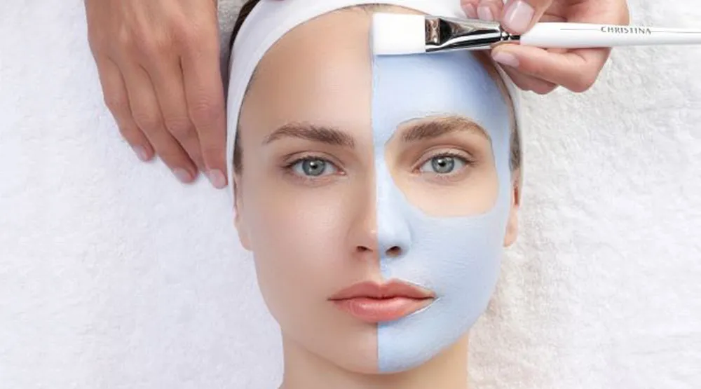 Pigmentflecken - Aufhellung (Vitamin - C - Behandlung)